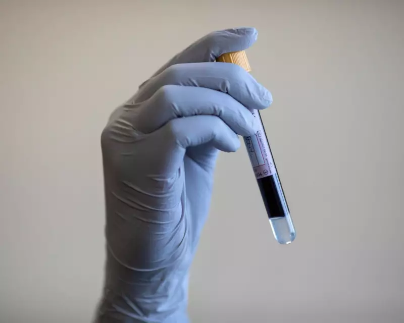 Targeted Prostate Screening Could Slash UK Deaths, Say Medical Experts