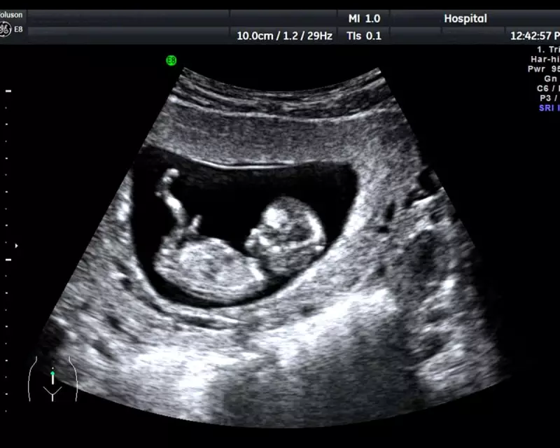 Hidden Danger in Pregnancy Scans: Unregulated Clinics Risking Lives Across UK