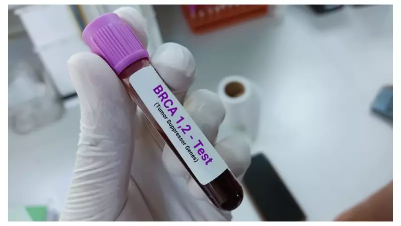 Prostate Cancer Screening Denied: Why NHS Advisers Say No