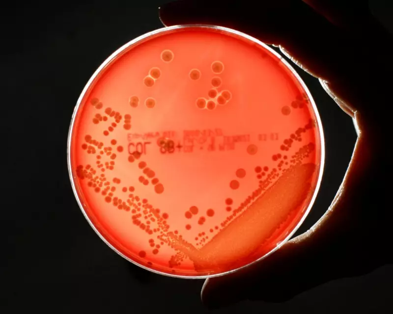Superbug Deaths Rise 17% in England as Antibiotic Resistance Grows