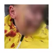 Boy, 5, Hospitalised with Facial Injuries After Dog Attack in Doncaster Park