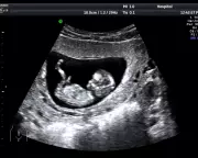 Hidden Danger in Pregnancy Scans: Unregulated Clinics Risking Lives Across UK