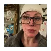 Pub owner nearly beaten to death then faces licence removal after attack