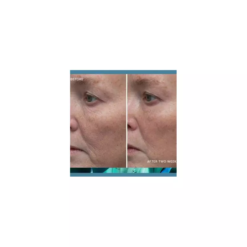 Elemis Anti-Ageing Cream Slashed to £59.58 in Amazon Deal