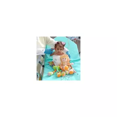 Conjoined twin Aruna dies months after separation surgery from sister