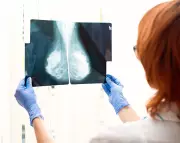 Breast Density Notifications Increase Anxiety and GP Visits, Study Reveals