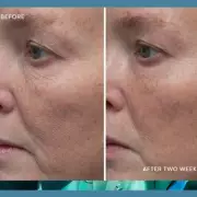 Elemis Anti-Ageing Cream Slashed to £59.58 in Amazon Deal