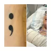 Tongue Cancer Surgery Moves Woman's Semicolon Tattoo From Arm to Mouth