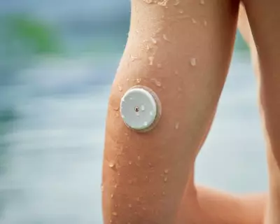 Ethnic Disparity in Diabetes Tech Access Revealed in England