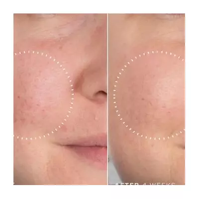 Medik8's 'Magic' Serum Earns Rave Reviews for 'Glass-Like' Skin Glow