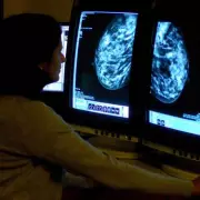 London's Breast Cancer Screening Crisis: Population Churn and Medical Mistrust Blamed