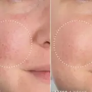 Medik8's 'Magic' Serum Earns Rave Reviews for 'Glass-Like' Skin Glow