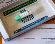 NHS England Boosts Bowel Cancer Test Accuracy to Save Lives