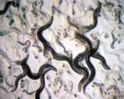 Parasite Cleanses Debunked: Why You Don't Need a Deworming Detox