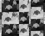 Epstein Files Expose Elite Networks and Special Treatment for the Powerful