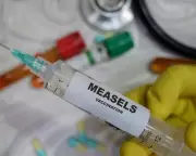 London Measles Outbreak Infects 60+ Children Amid Low Vaccination Rates