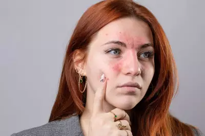 Beauty Editor's Redness Solution: Clinique Cream Earns Rave Reviews