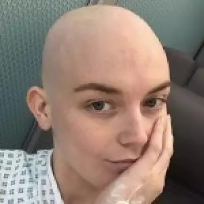 Itchy Skin Led to Stage 4 Cancer Diagnosis at Age 26