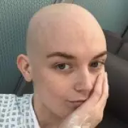 Itchy Skin Led to Stage 4 Cancer Diagnosis at Age 26