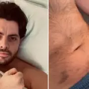 TOWIE Star Jordan Brook Battles Meningitis and Encephalitis in Hospital