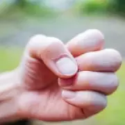 What Your Fingernails Reveal About Your Health: 10 Warning Signs