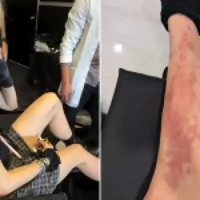 Taylor Momsen Hospitalized After Venomous Spider Bite During AC/DC Tour