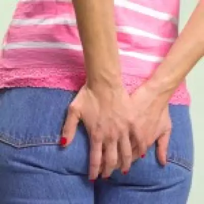 Thong Underwear Blamed for Painful Pilonidal Cysts in Viral Health Alert