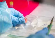 CDC Halts Infectious Disease Testing Amid Staffing Crisis, Impacting Rabies and More
