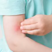 Spider Bite Hospital Admissions Double in England as False Widow Population Explodes