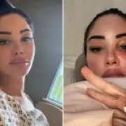 Tulisa Reveals Bell's Palsy Attack and Temporary Paralysis in Health Ordeal