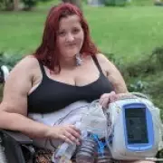 Woman's 'Unfixable' Giant Hernia Revealed After Multiple Surgeries