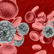 World First: HIV Patient Cured Through Brother's Stem Cell Transplant
