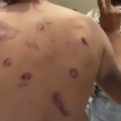 Gaza Flotilla Activists Show Wounds from Israeli Detention