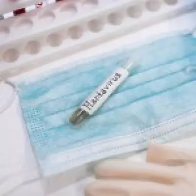 Hantavirus in Semen: Could It Become a New STI? Experts Weigh In