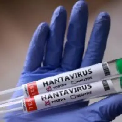 Hantavirus Survivor Recalls 'Hell on Earth' with Covid-Like Symptoms