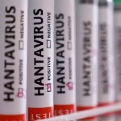 Hantavirus Vials Missing from Lab Two Years Before Cruise Outbreak