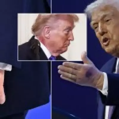 Trump to undergo third medical checkup in 13 months amid health concerns