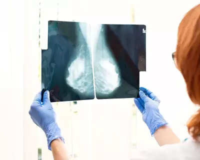 Why Routine Cancer Tests Have Age Limits Explained