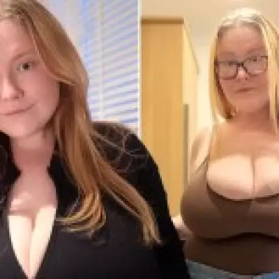 Woman with Gigantomastia Has Britain's Biggest Breasts, Still Growing