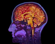 How Negative Expectations Can Make You Ill: The Nocebo Effect Explained