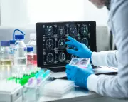 UK Alzheimer's Patients Miss Trials Due to Slow Diagnosis, Charity Warns