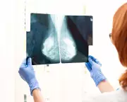 Why Routine Cancer Tests Have Age Limits Explained