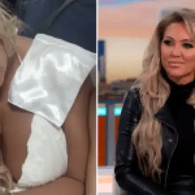 Big Brother star Aisleyne Horgan-Wallace 'scarred for life' after XL Bully attack