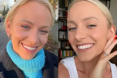 MySweetSmile Whitening Pen Review: Does It Really Work?