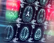 Antidepressants and Antipsychotics Could Replace Opioids for Pain Relief, Study Finds
