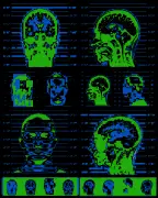 Brain scan scientist's disputed evidence used in death penalty cases