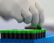 Mpox smuggling case prompts US House committee to scrutinize NIH