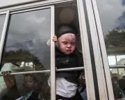 Nigerian with albinism deported under Trump asylum crackdown despite siblings' success