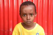 Somali boy, 7, may lose ability to walk without surgery after US airstrike