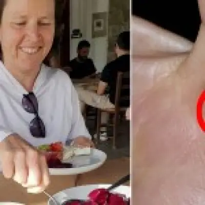Woman bitten by bat on holiday saved by Google Lens rabies warning